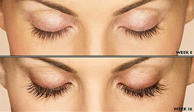 Latisse-reviews Latisse, FDA, Bimatoprost, eyelash growth product, Latisse reviews